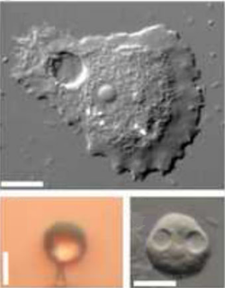 <i>Luapeleamoeba hula</i> Species of acanthamoebid amoeba