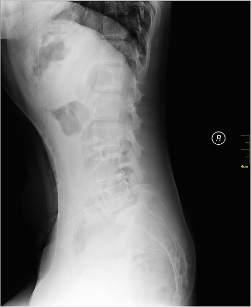 File:Medical X-Ray imaging SUC07 nevit.jpg