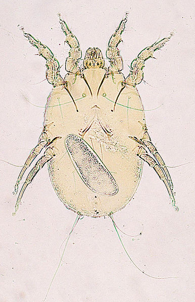 File:Megninia-feather-mite.JPG