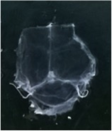 Example of a meningeal whole-mount taken from an adult mouse. Laying the whole-mount on a glass slide allows for histological analysis of the entire dura, including the superior sagittal and transverse sinuses. Mouse whole-mount meninges.png
