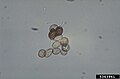 Uromyces appendiculatus, Urediniospores and teliospores, 5363961.jpg