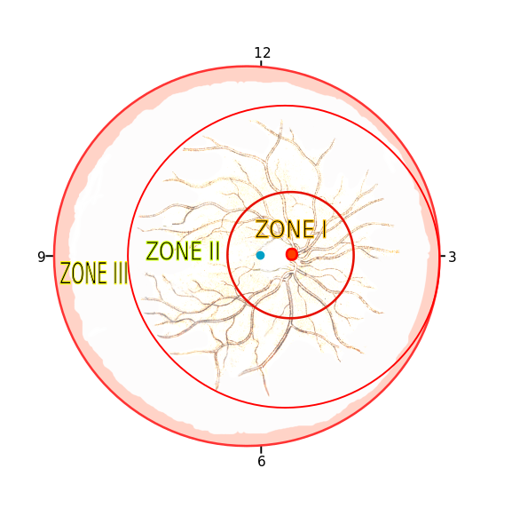 ไฟล์:Zone1.2.3.svg