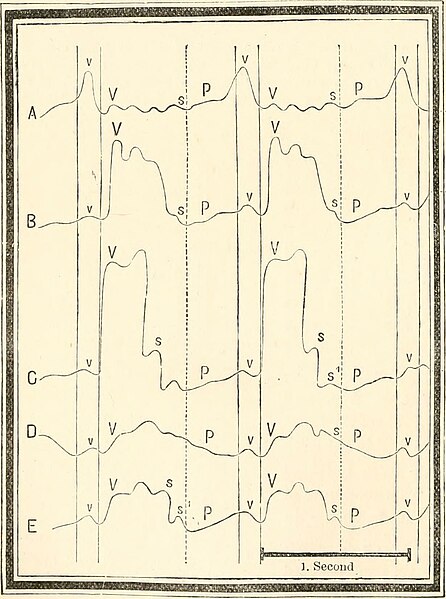 File:A manual of human physiology, including histology and microscopical anatomy, with special reference to the requirements of practical medicine (1885) (14594648649).jpg