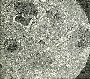 Американский журнал акушерства и гинекологии (1920) (14745090456) .jpg