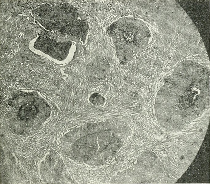 File:American journal of obstetrics and gynecology (1920) (14745090456).jpg