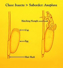 Louse hatching Anoplura hatching.jpg