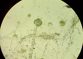 Aspergillus oryzae під мікроскопом