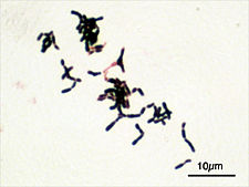 Bifidobacterium adolescentis barveno dle Gramma