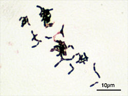 Bifidobacterium adolescentis Gram.jpg