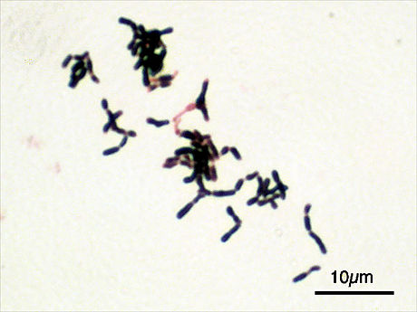 Actinobacteriën