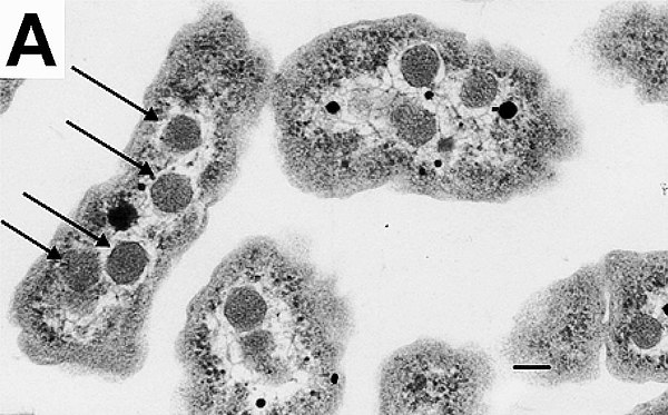 An electron micrograph of Halothiobacillus neapolitanus cells with carboxysomes inside, with arrows highlighting visible carboxysomes. Scale bars indi