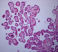 Histologie des plexus choroïdes[3].