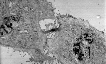 Elektronska mikrografija citokineze u mitozi: centrozom označen strelicom
