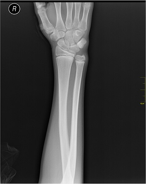 File:Medical X-Ray imaging QZV06 nevit.jpg