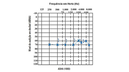 Parecer Audiológico 1i