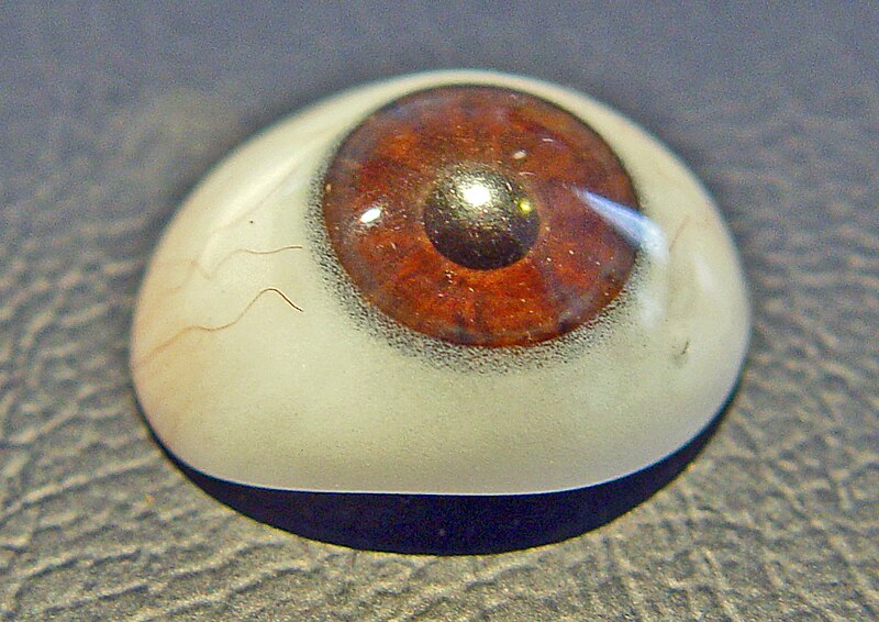 File:Scleral shell prosthesis.jpg