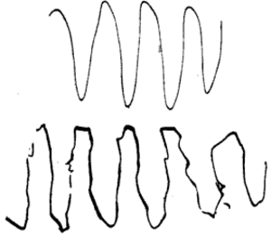 Cerebellum