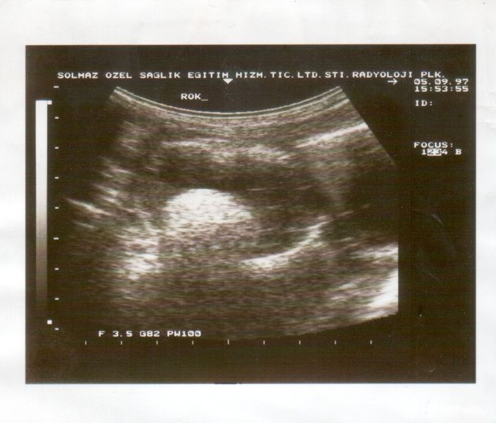 File:Ultrasound Scan ND 333.jpg