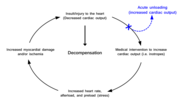 Thumbnail for Acute cardiac unloading