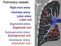 On CT scan, pulmonary emboli can be classified according to level along the arterial tree.