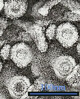 TEM мікрофотографія з зображенням HBV