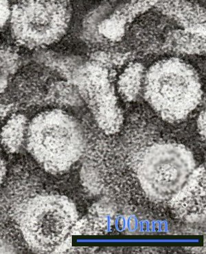 Електронний мікрознімок часточок вірусу гепатиту B та поверхневого антигену в крові.