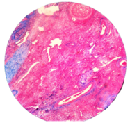 Histology- Ovary (mammalian).png