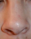 Human-nose.jpg