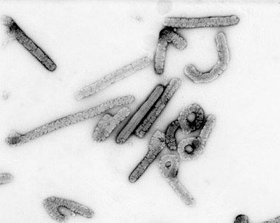 Marburg Marburgvirus Wikiwand