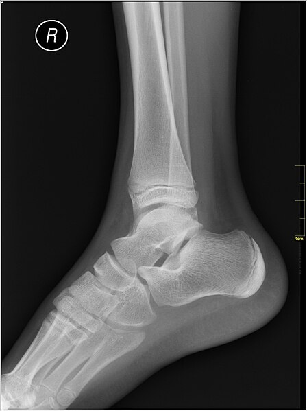File:Medical X-Ray imaging QER06 nevit.jpg