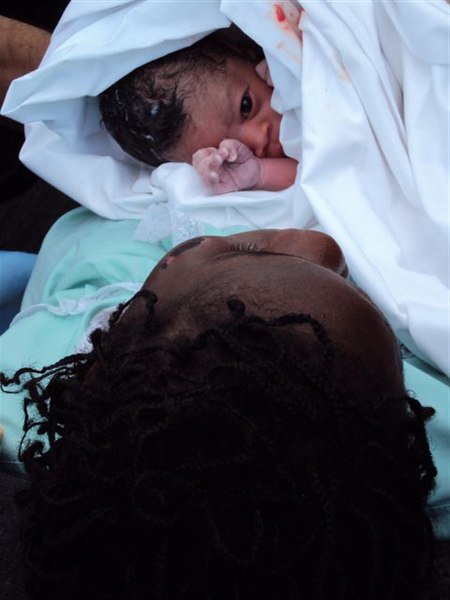 File:CG Assisted Mom Give Birth to Child (4285509402).jpg