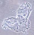 Miniatuur voor Bestand:Clue cells - CDC PHIL 3720.jpg