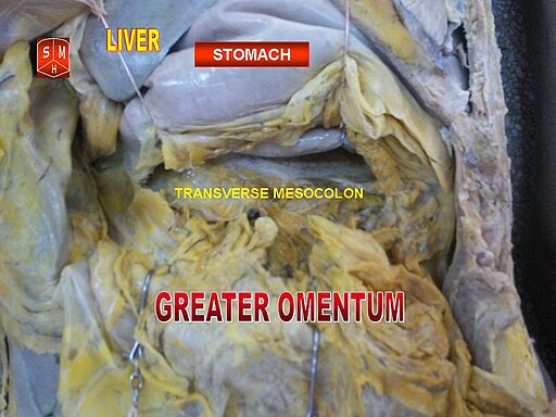 Greater omentum 1