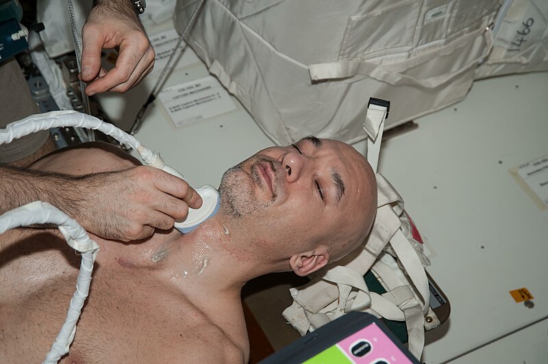 File:ISS-36 Luca Parmitano Spinal Ultrasound.jpg