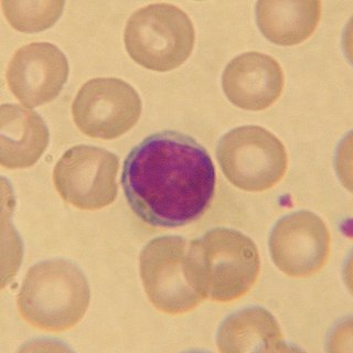 Wrights stain Hematologic stain that facilitates the differentiation of blood cell types