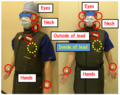 Measurement points during CT-guided intervention (eye, neck, hands, and out - inside of lead apron for estimating the effective dose).png