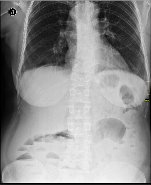 File:Medical X-Ray imaging RME07 nevit.jpg