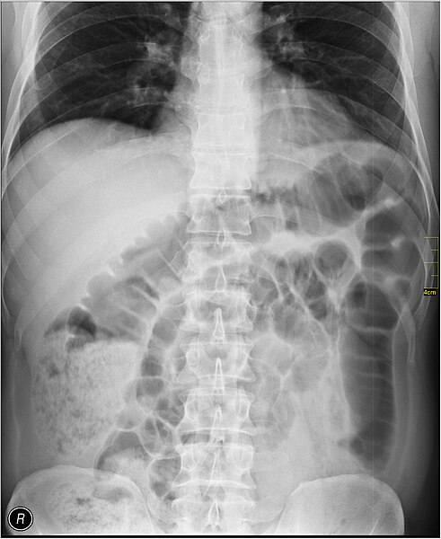 File:Medical X-Ray imaging UDP07 nevit.jpg