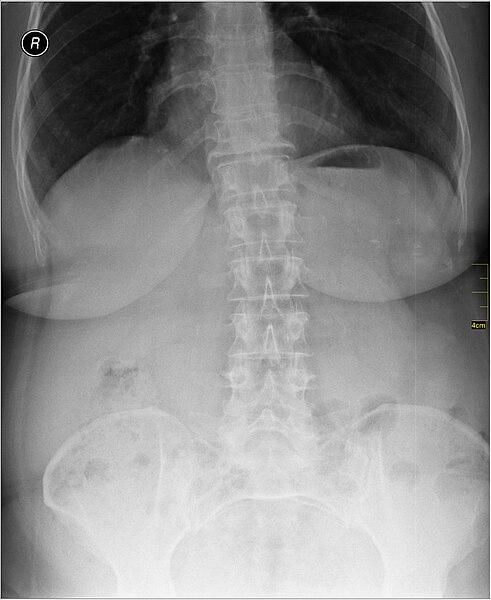 File:Medical X-Ray imaging WIW07 nevit.jpg