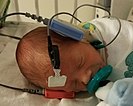 A newborn infant undergoes a hearing screening.
