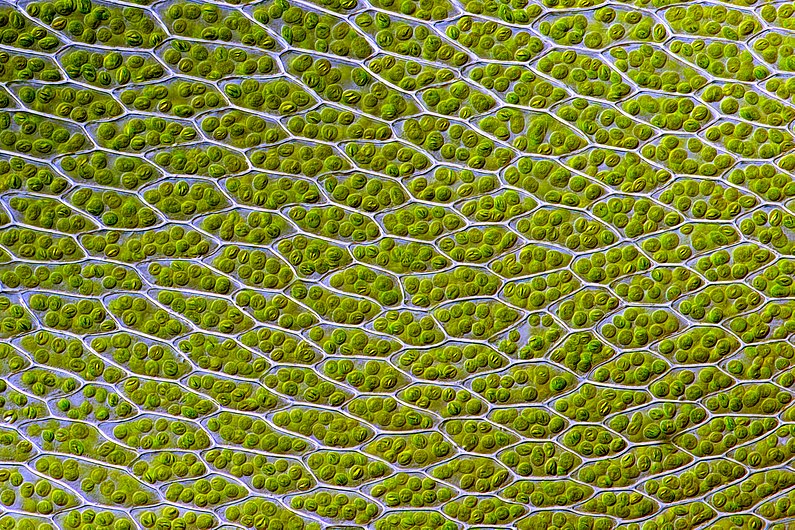 Bryum capillare leaf cells.jpg