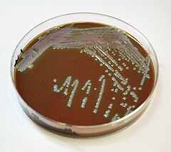 Agar czekoladowy z bakterią Francisella tularensis