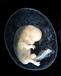 Vorschaubild für Embryogenese (Mensch)