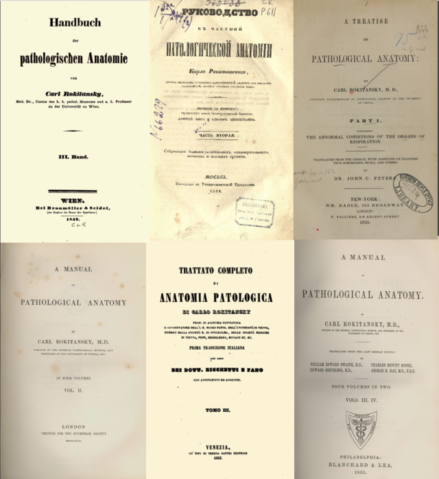 Carl Rokitansky, Handbuch der pathologischen Anatomie, deutsche, russische, englische und italienische Ausgaben