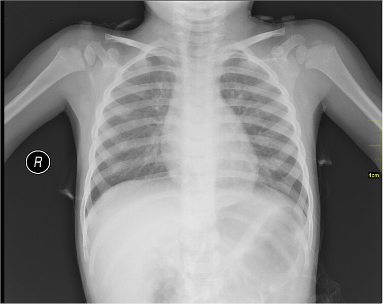 File:Medical X-Ray imaging QJK06 nevit.jpg