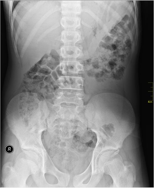 File:Medical X-Ray imaging QZS06 nevit.jpg