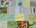 Thumbnail for File:Morphological diversity in cyanobacteria.webp