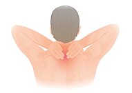 Neck pain illustration.jpg