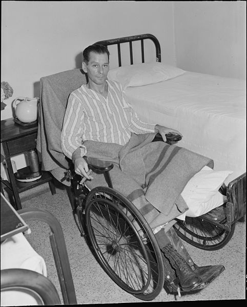 File:Robert Lee Donley who works for the Pocahontas Corporation, at the Amonate Mine, lost a leg when he was crushed... - NARA - 541090.jpg