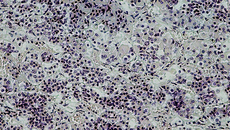 File:Rosette of Pinealocytes in Young Human Pineal Gland (40406903783).jpg